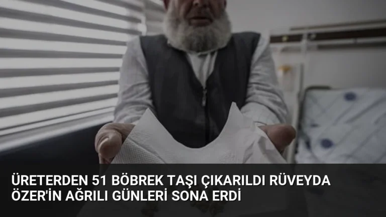 Üreterden 51 Böbrek Taşı Çıkarıldı Rüveyda Özer’in Ağrılı Günleri Sona Erdi