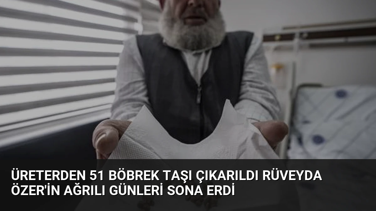 Üreterden 51 Böbrek Taşı Çıkarıldı Rüveyda Özer’in Ağrılı Günleri Sona Erdi