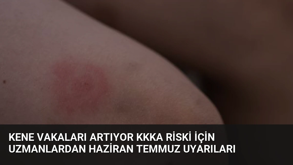 Kene Vakaları Artıyor KKKA Riski İçin Uzmanlardan Haziran Temmuz Uyarıları