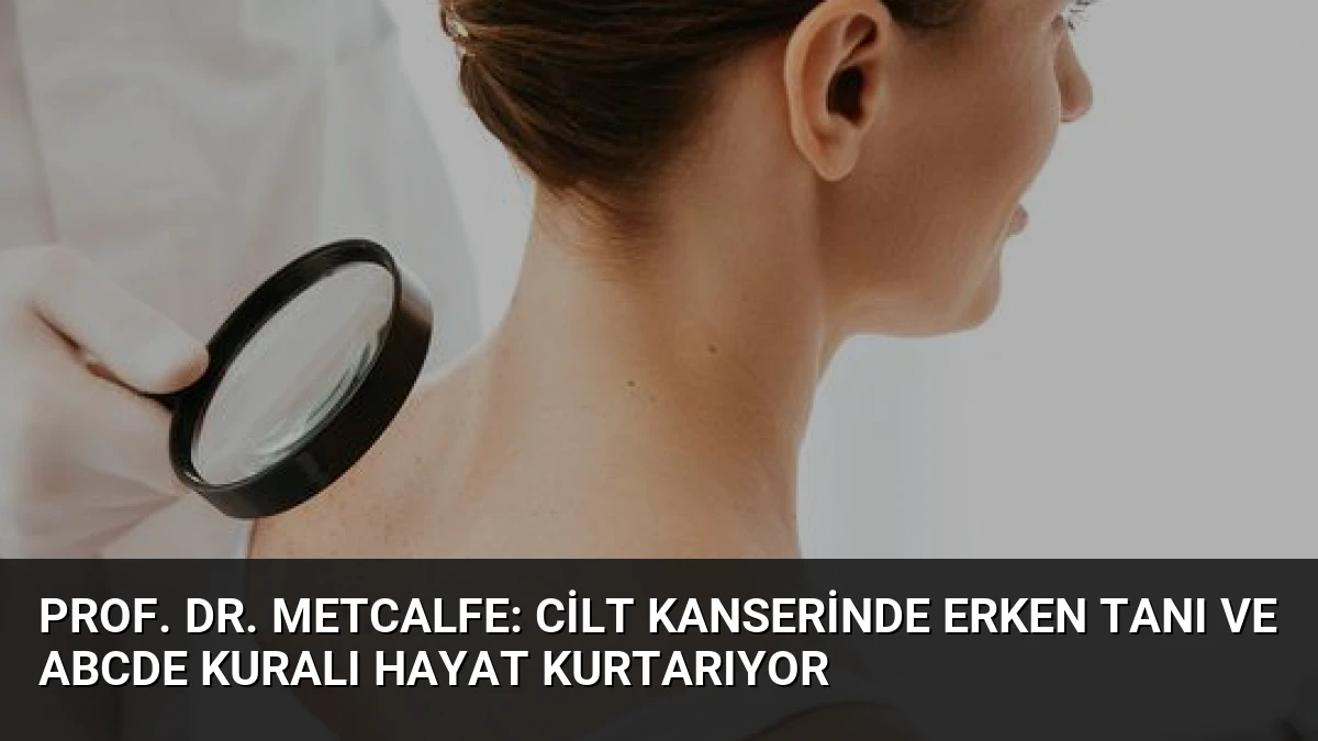 Prof. Dr. Metcalfe: Cilt Kanserinde Erken Tanı ve ABCDE Kuralı Hayat Kurtarıyor